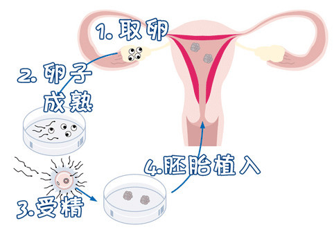 好孕故事